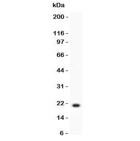 HSPB1 / HSP27 Antibody