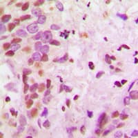 Polyclonal Rabbit anti-Human HNRNPA2B1 Antibody (N-Terminus, IHC, IF, WB)
