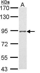 PR / Progesterone Receptor Antibody (aa18-112)