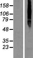TMEM8A Protein (Over-Expression Lysate Myc-DDK (Flag))