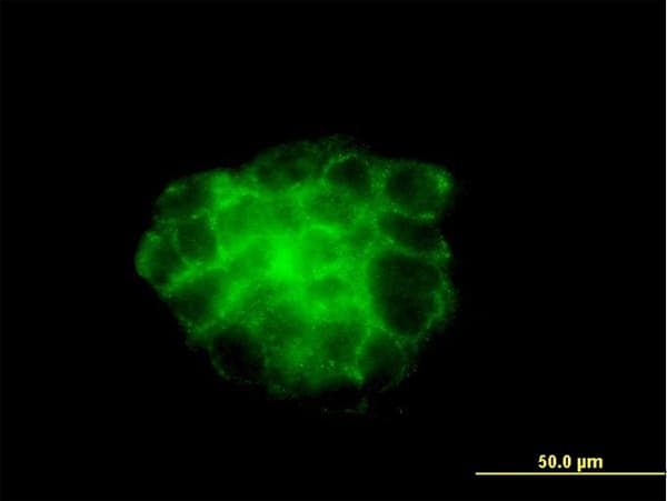 PathPlus™ KRT4 / CK4 / Cytokeratin 4 Antibody (clone 5H5)