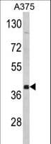 PTAR2 / FNTA Antibody (aa330-360)