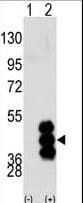 PHKG2 Antibody (aa41-71)