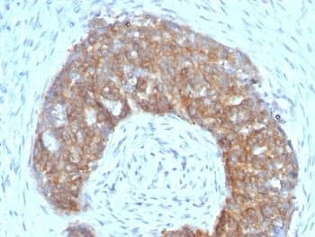 TFF1 / pS2 Antibody (aa57-84, clone SPM313)