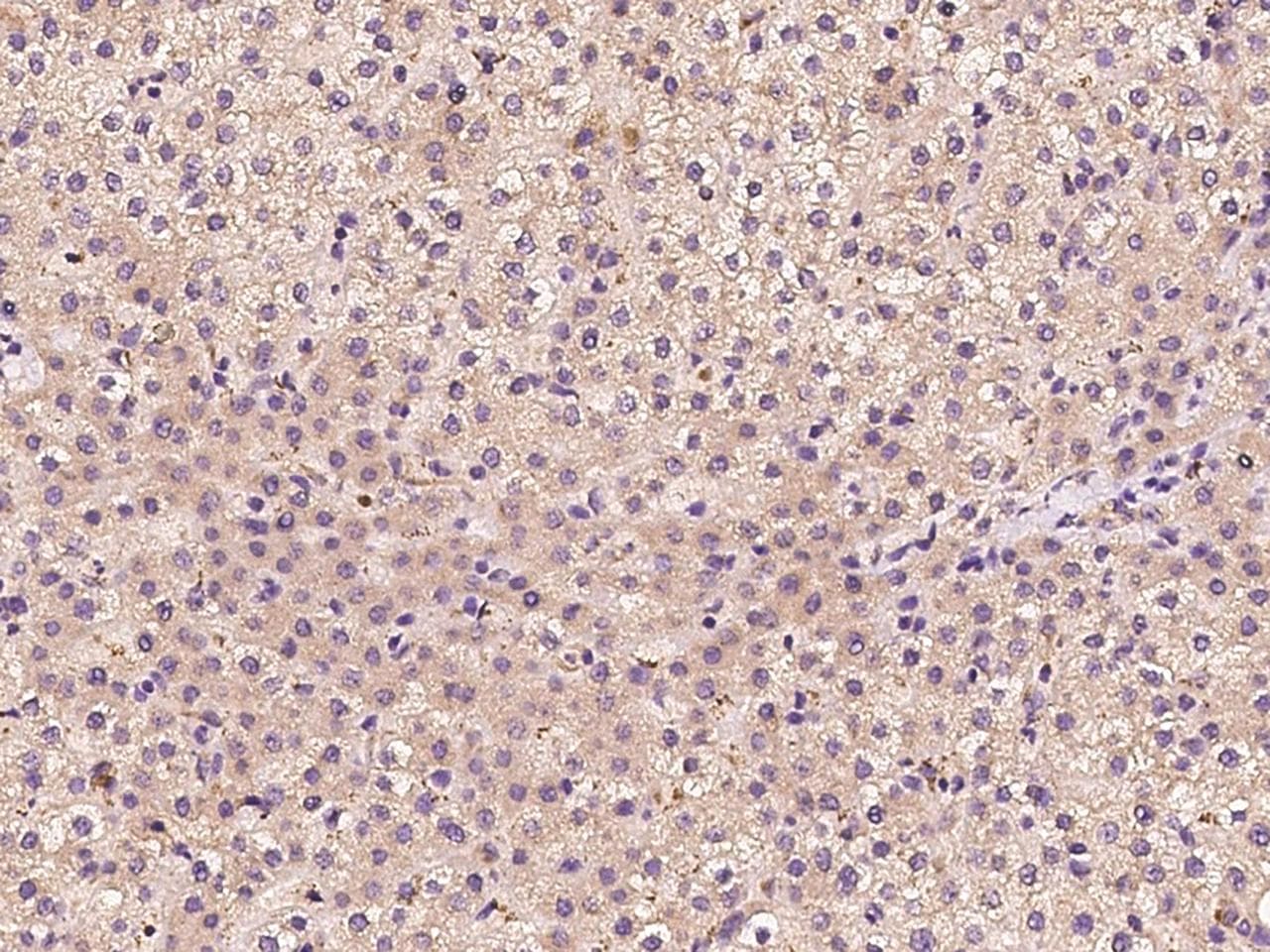 STARD7 Antibody
