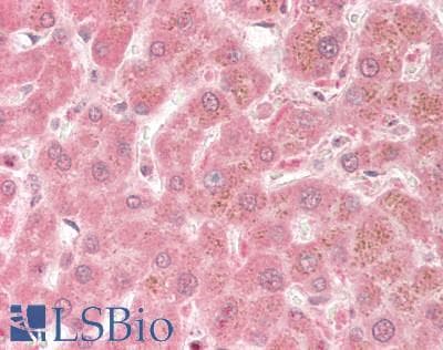 IHC-plus™ TLR3 Antibody (aa180-385, clone ABM24E5)