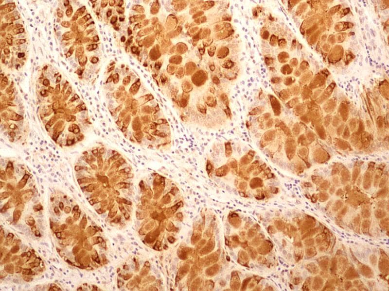 IL27RA Antibody (aa200-250, clone 34N4G11)