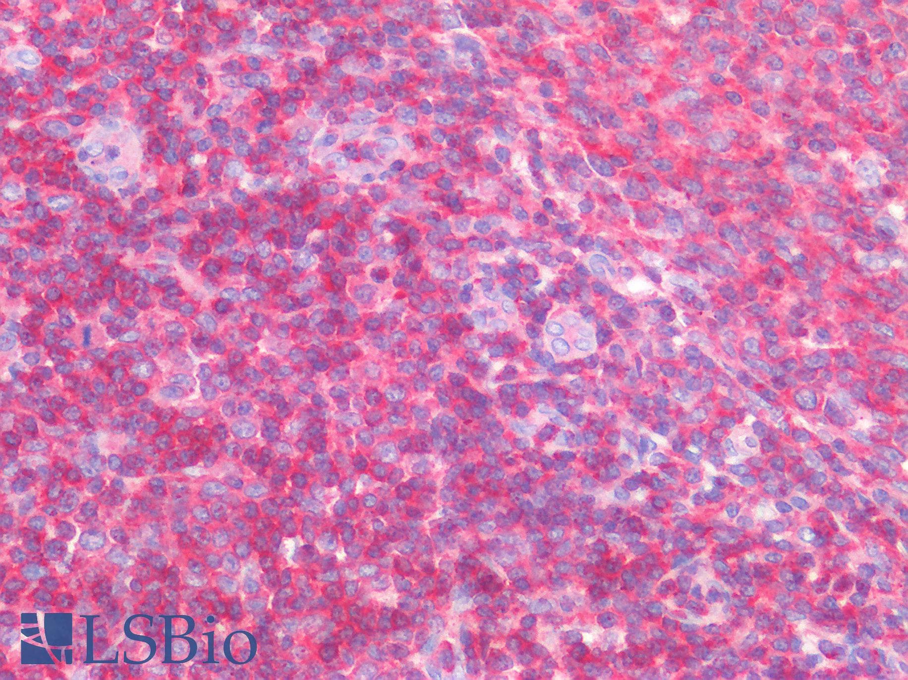 IHC-plus™ CFL1 / Cofilin Antibody (N-Terminus)