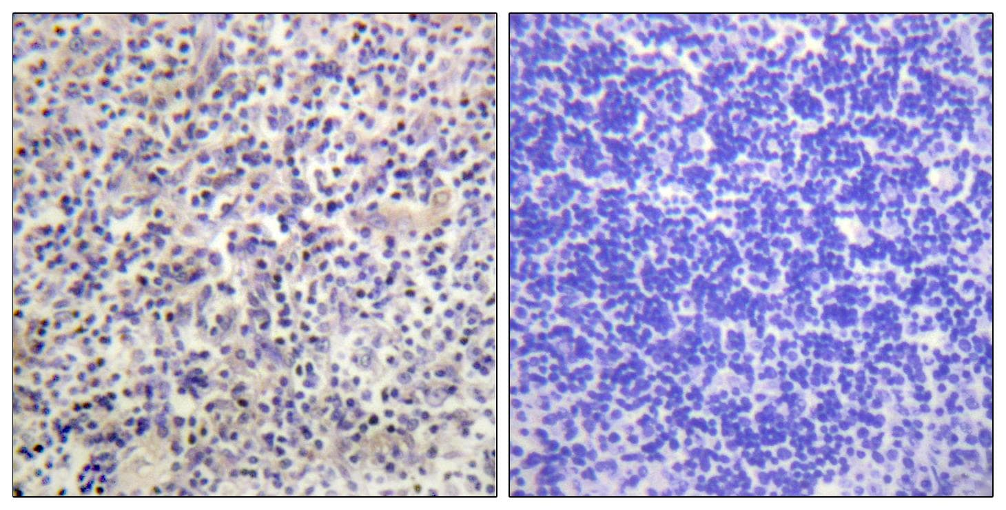 HBP1 Antibody (Ab-402)