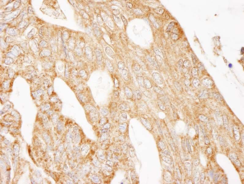 IHC-plus™ IRS2 / IRS-2 Antibody (aa1288-1338)