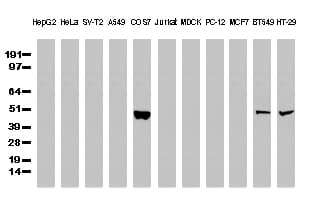 TP53 / p53 Antibody (clone UMAB55, Carrier-free)