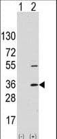 SSR1 Antibody (aa17-46)