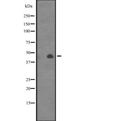 CANT1 Antibody