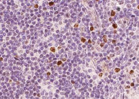 RELA / NFKB p65 Antibody (phospho-Ser311)