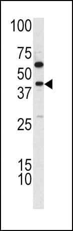TDG / Thymine DNA Glycosylase Antibody (aa281-310)