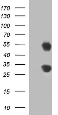 GADD45A / GADD45 Antibody (clone OTI2B7)