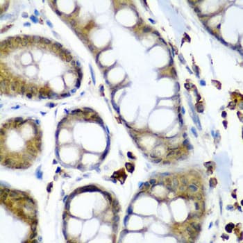 Polyclonal Rabbit anti-Human SECISBP2 / SBP2 Antibody (IHC, IF, WB)
