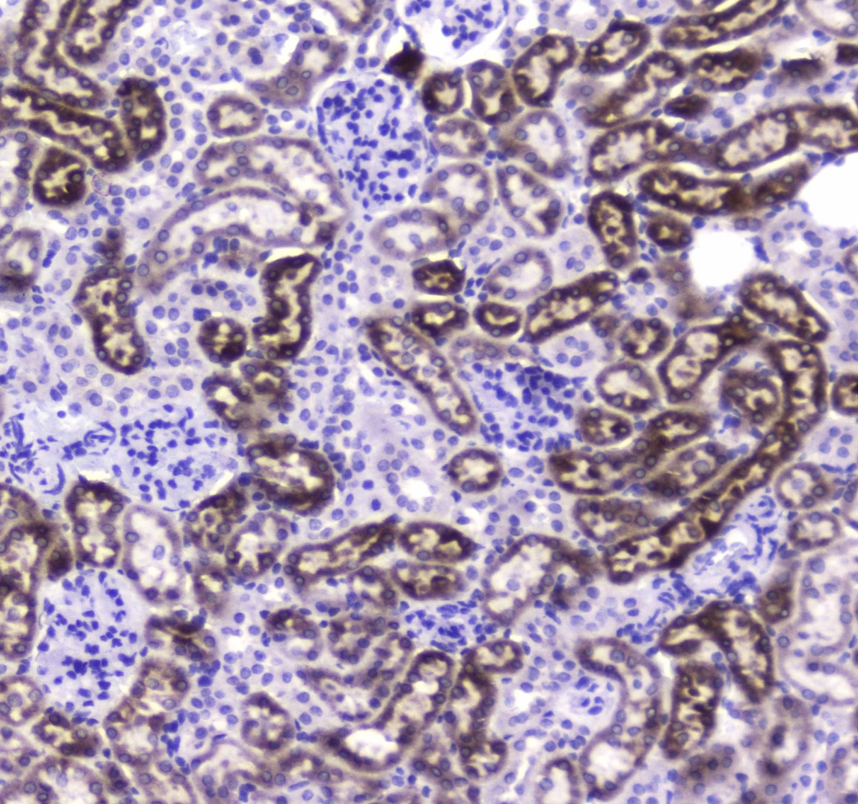 Carboxylesterase 1 / CES1 Antibody