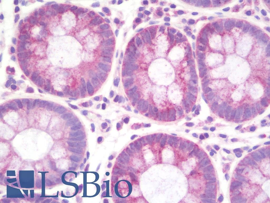 IHC-plus™ CYP2U1 Antibody (aa281-330)