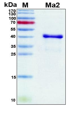 Human PNMA2 / MA2 Protein (Recombinant 6His, N-terminus)