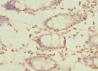 Polyclonal Rabbit anti-Human SLC23A2 / SVCT2 Antibody (IHC, WB)