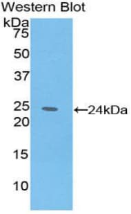 IL6 / Interleukin 6 Antibody (aa30-208)