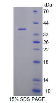 Mouse RGN / Regucalcin Protein (Recombinant His)