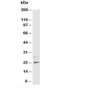 Polyclonal Rabbit anti-Human NGF Antibody (aa162-173, WB)