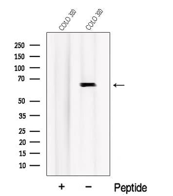 NR4A2 / NURR1 Antibody