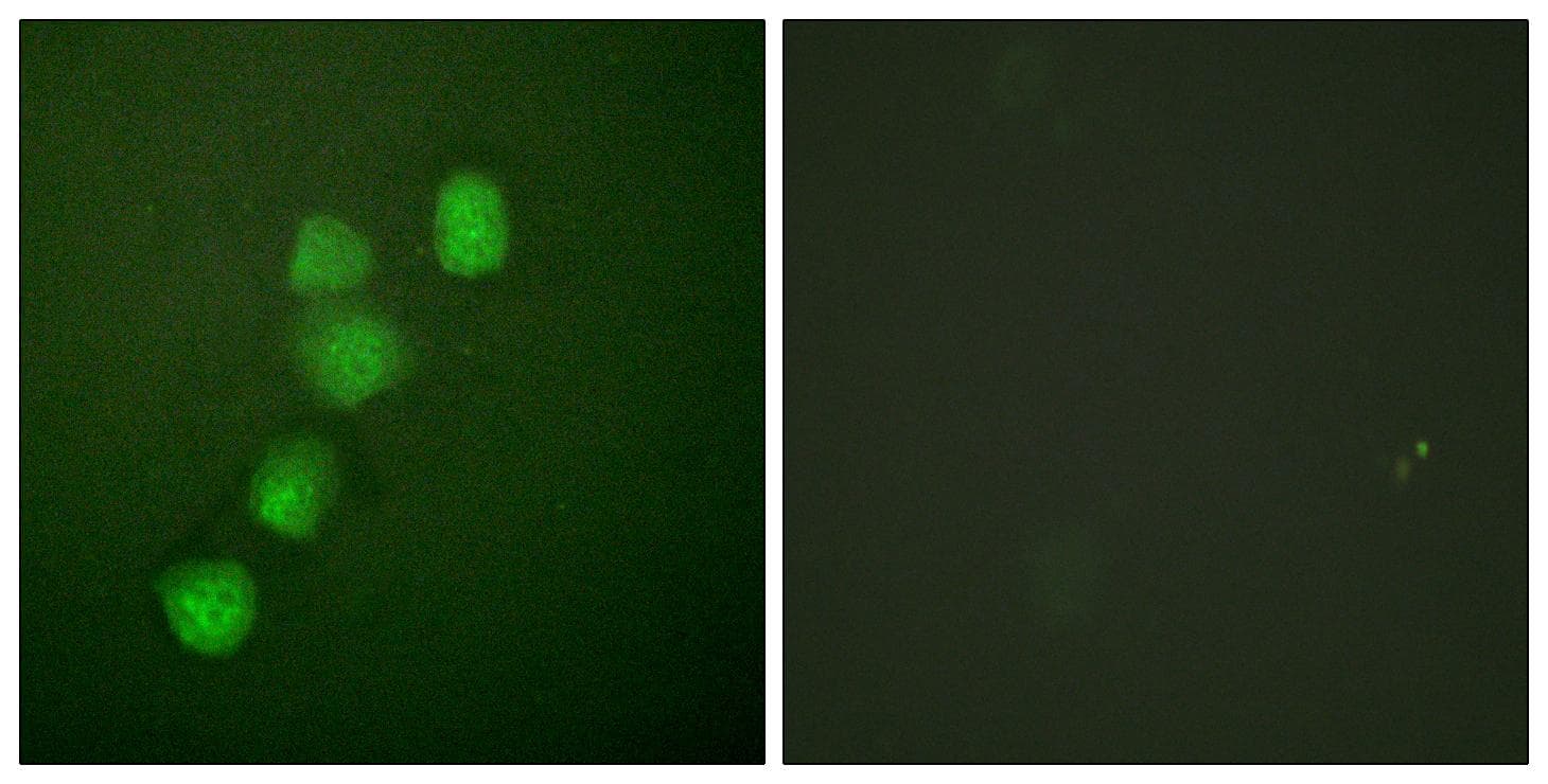 CCNE1 / Cyclin E1 Antibody (p395)