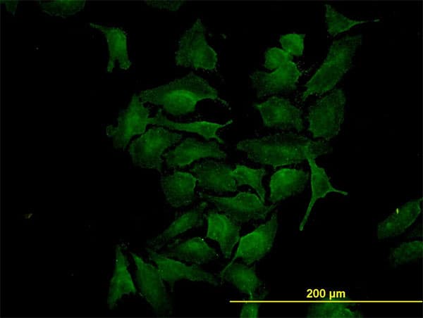 Monoclonal Mouse anti-Human CDK4 Antibody (clone 4F11, IF, WB)