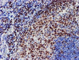 MEF2C Antibody (clone OTI2F2)