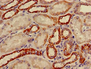 CYP11B2 / Aldosterone Synthase Antibody