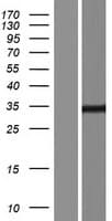 SPEF1 / C20orf28 Protein (Over-Expression Lysate Myc-DDK (Flag))