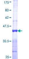 Human TP1 / TEP1 Protein (Recombinant GST, N-terminus)
