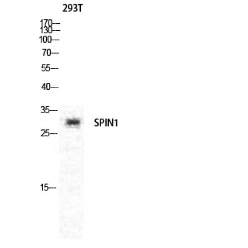SPIN / SPIN1 Antibody (80-160 aa, Internal)