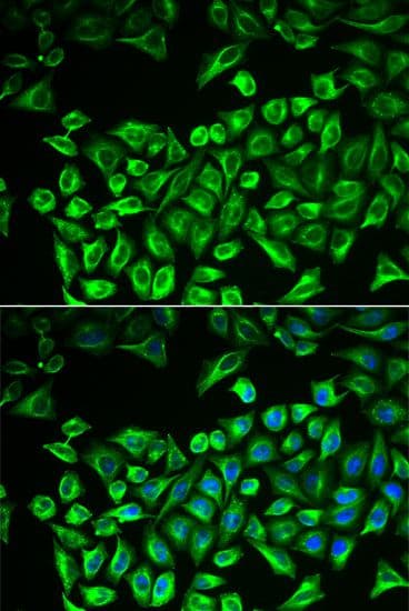 HAS3 Antibody