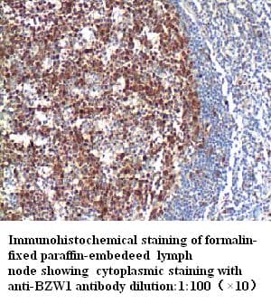BZW1 / BZAP45 Antibody