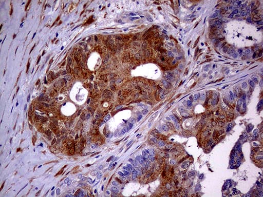 p16INK4a / CDKN2A Antibody (clone OTI11E9)