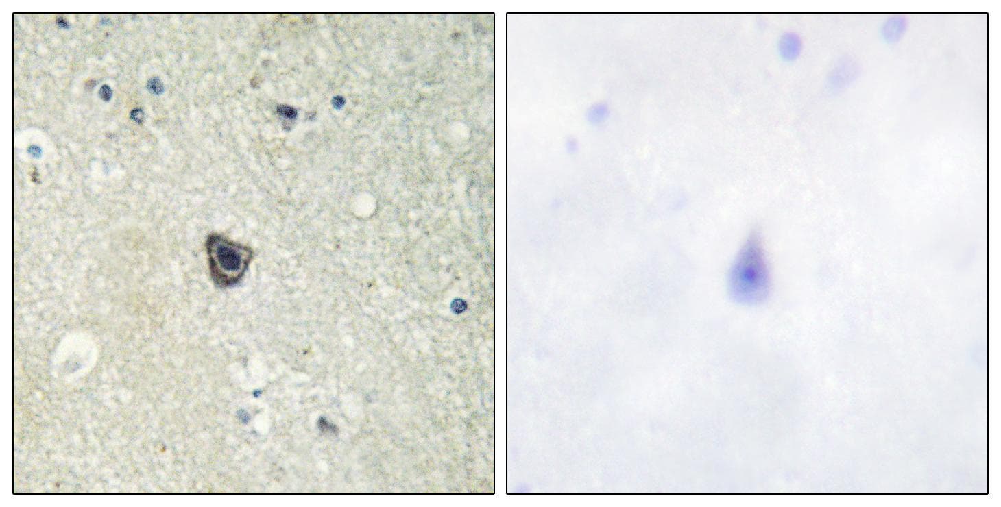 CSF1R / CD115 / FMS Antibody (p809)