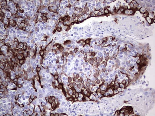 Monoclonal Mouse anti-Human KRT19 / CK19 / Cytokeratin 19 Antibody (clone OTI5F4, aa240-390, IHC, WB)