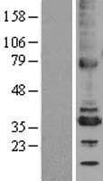 TMX2 / TXNDC14 Protein (Over-Expression Lysate Myc-DDK (Flag))
