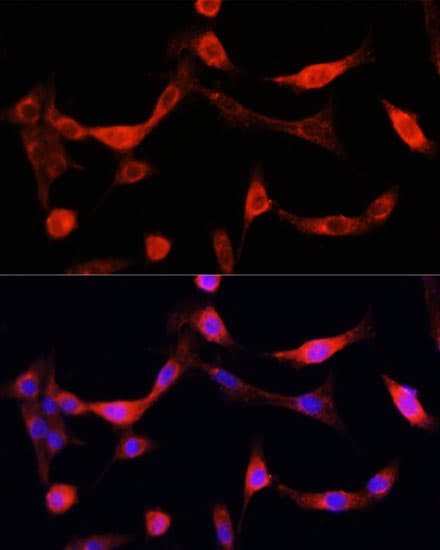 Polyclonal Rabbit anti-Human EGFR Antibody (IHC, IF, WB)