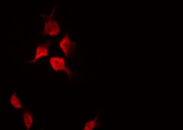 Polyclonal Rabbit anti-Human CDKN1A / WAF1 / p21 Antibody (phospho-Thr145, IHC, IF, WB)