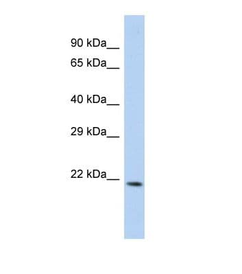 CEACAM21 Antibody (aa61-110)