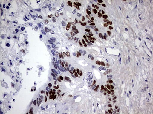 TP53 / p53 Antibody (clone DO-1)