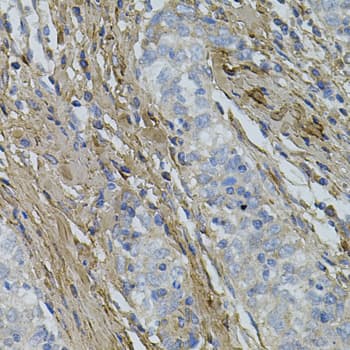 Polyclonal Rabbit anti-Human COL1A1 / Collagen I Alpha 1 Antibody (aa100-200, IHC, WB)