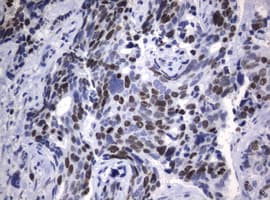 Monoclonal Rat anti-Human MKI67 / Ki67 Antibody (clone OTI9C3, IHC, WB)