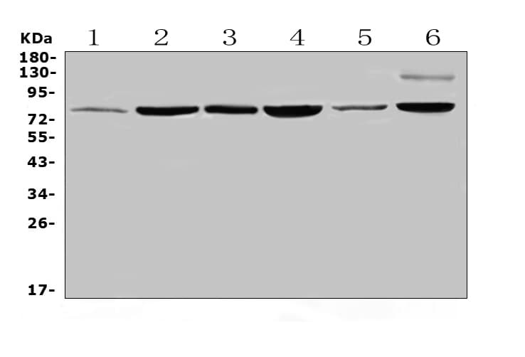 Polyclonal Rabbit anti-Human HSD17B4 Antibody (IHC, WB)