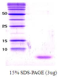 Human SNCA / Alpha-Synuclein Protein (Recombinant)